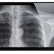 Diagnosis apps